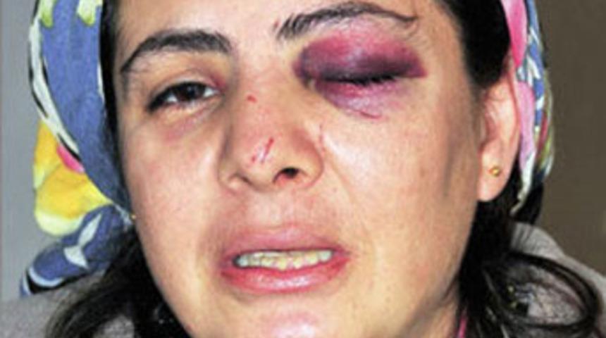 Koca dehşeti! Eşini 7 saat dövdü