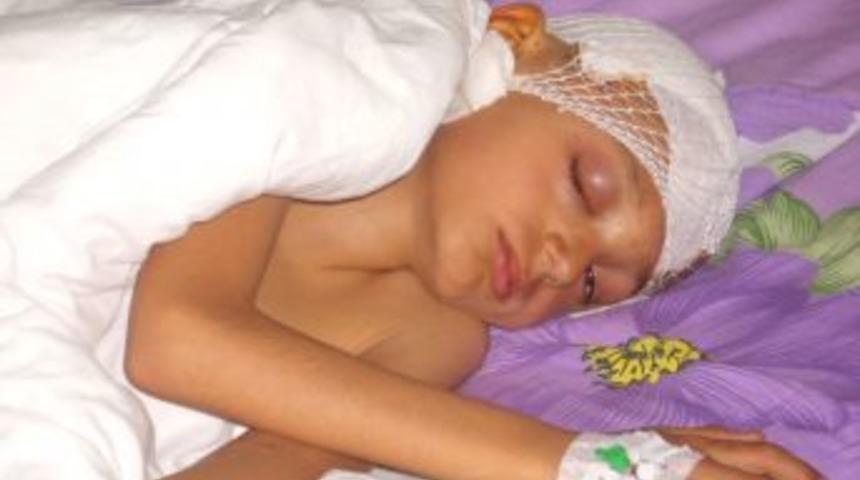 Kafatasının bir kısmını bacağında taşıyacak