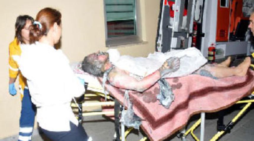 Gen&ccedil; kız benzin d&ouml;k&uuml;p kendisin yaktı