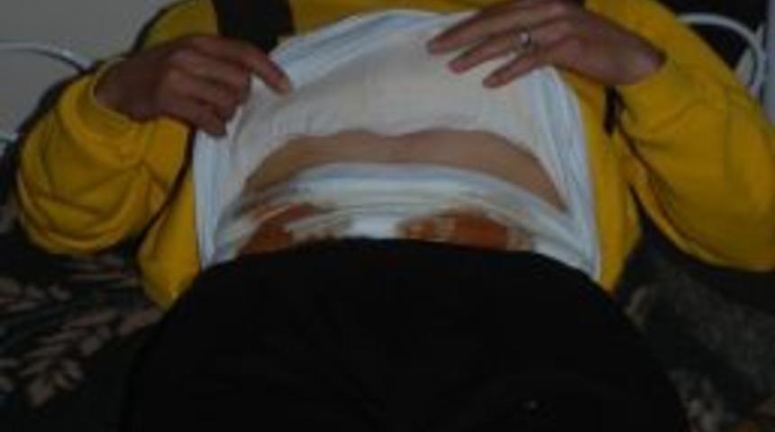 Suriyeliler sağlık merkezine d&ouml;n&uuml;şt&uuml;r&uuml;len kiralık evlerde tedavi g&ouml;r&uuml;yor