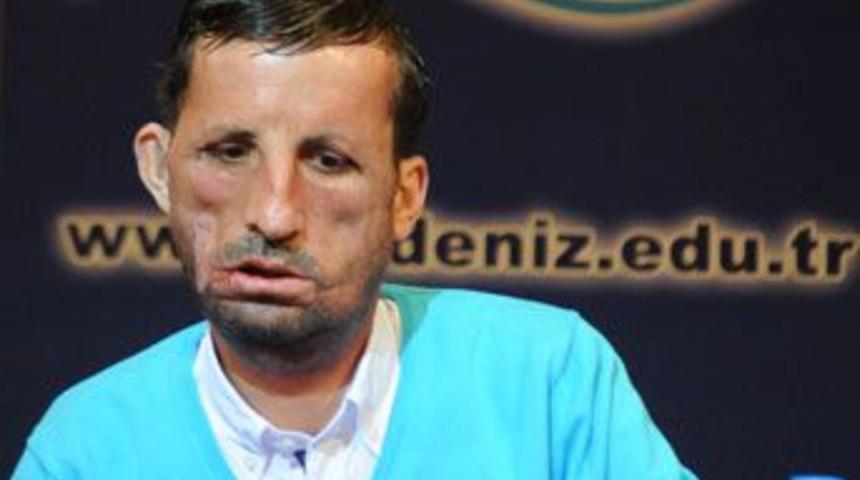 Uğur Acar taburcu oldu