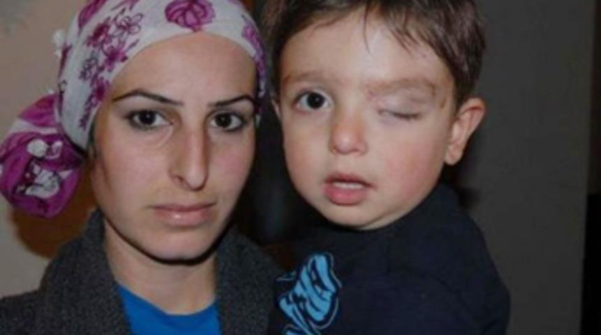 &Uuml;&ccedil; yaşındaki Doğukan'ın &ccedil;ekmediği acı kalmadı