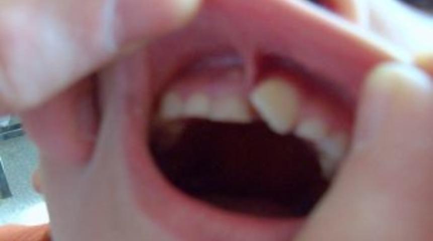 Kars&rsquo;ta 'Evde Ağız ve Diş Sağlığı&rsquo; hizmeti uygulanacak