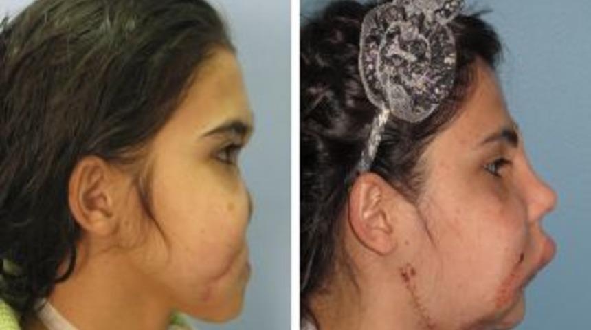 Hatice Nergis'in Yeni Y&uuml;z&uuml; İlk Kez Kamuoyuna G&ouml;sterildi