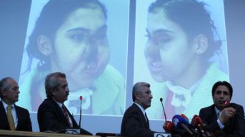 Y&uuml;z naklinin ger&ccedil;ekleştirildiği ilk kadın hasta kameraların karşısına ge&ccedil;ti