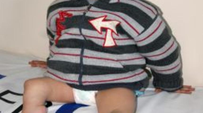 Ağrılı k&uuml;&ccedil;&uuml;k İbrahim y&uuml;r&uuml;mek i&ccedil;in destek bekliyor