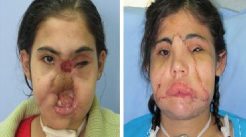 Y&uuml;z Nakli Olan Hatice Nergis'in Fotoğrafları Basına Dağıtıldı