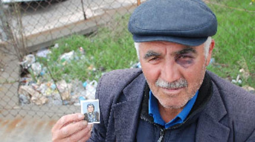 Kocasının gözünü morarttı