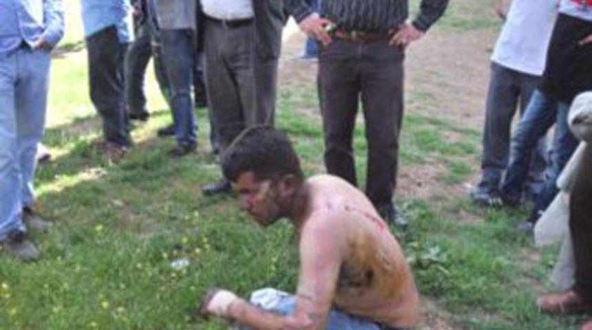 Diri diri yakmaya kalkıştı