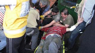 Eli pres makinesine sıkıştı