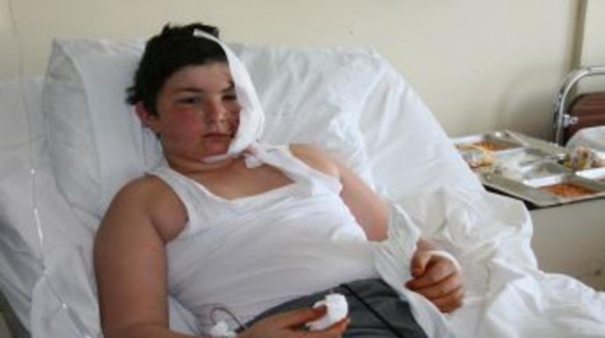 Pitbull'u Boğarak &Ouml;ld&uuml;ren Yunus Dehşet Anlarını Anlattı