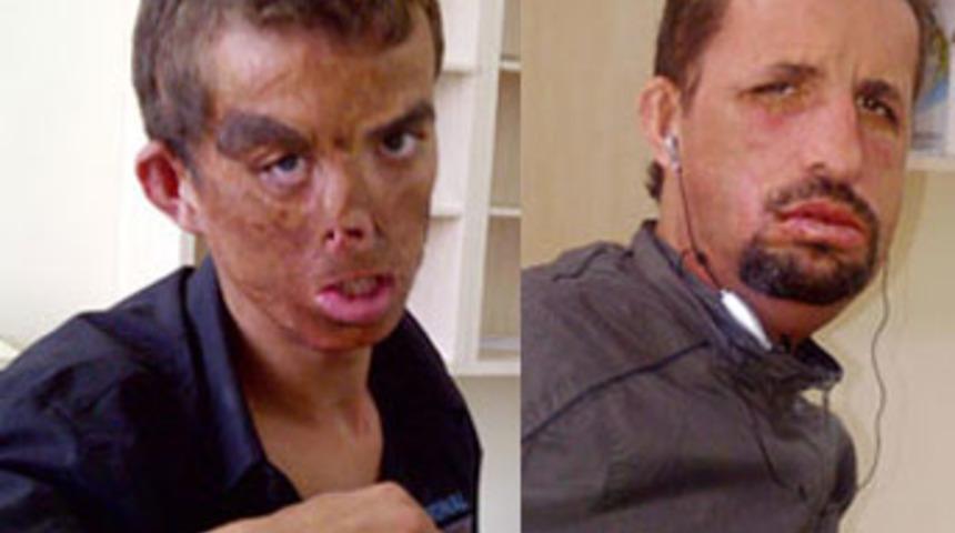 Y&uuml;z nakliyle gelen m&uuml;thiş değişim