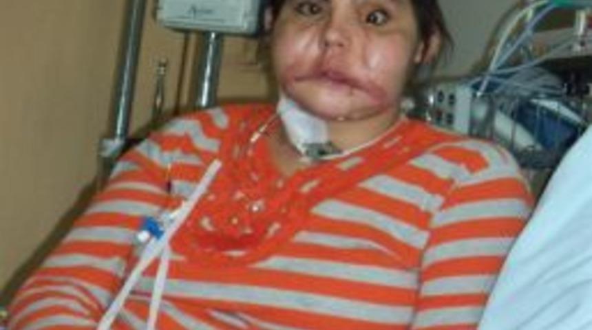 Hatice &Ccedil;ene Ameliyatı Olacak