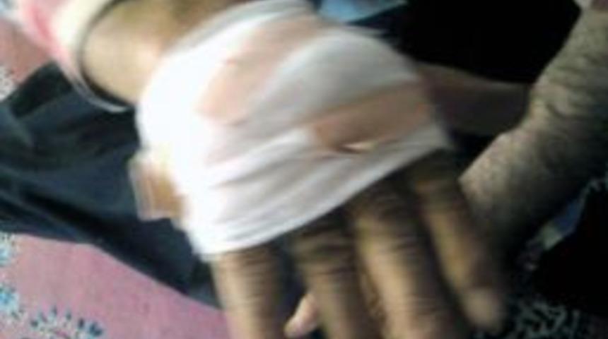 Eşeğin ısırdığı adam hastanelik oldu