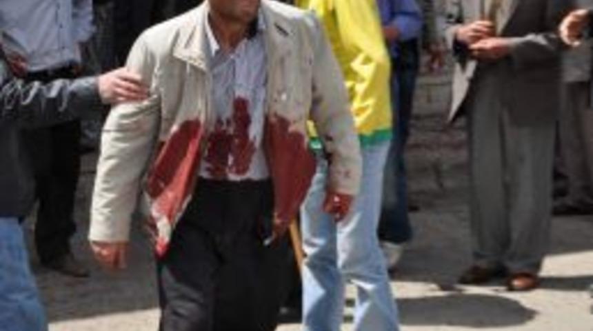 K&ouml;yde Başlayan Arazi Anlaşmazlığı Şehirde &Ccedil;atışmaya D&ouml;n&uuml;şt&uuml;: 15 Yaralı