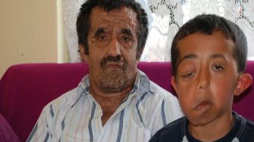 V&uuml;cudunu saran t&uuml;m&ouml;rleri tıp durduramadı, durumu giderek ağırlaşıyor