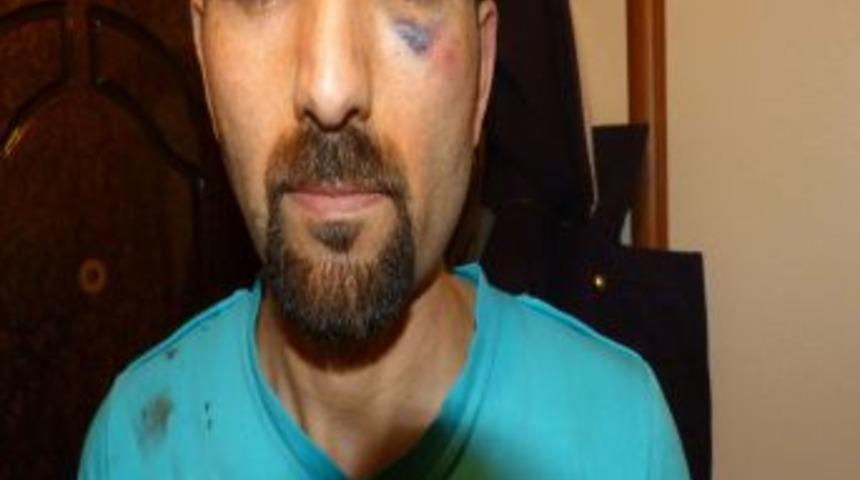 &Ouml;nce şof&ouml;rden, sonra 15 polisten dayak yedi