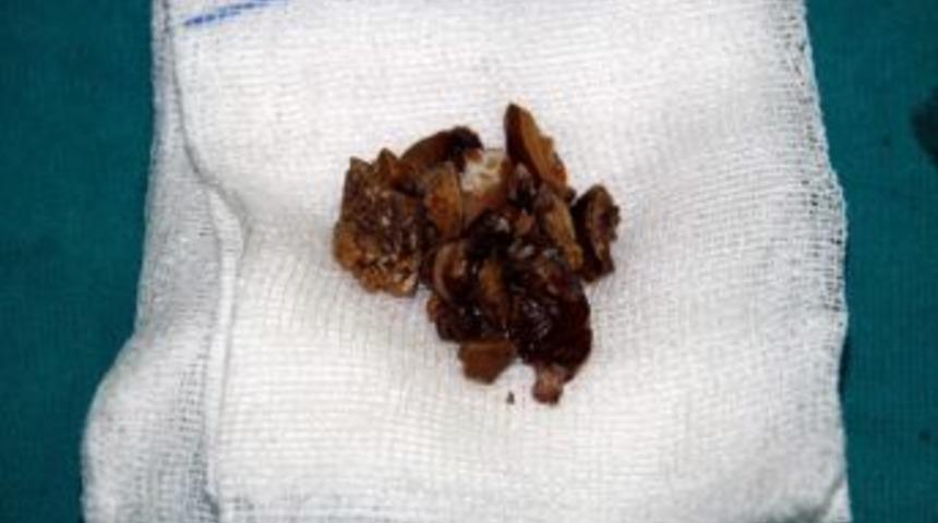 &Ccedil;arşamba'da İlk Ameliyat