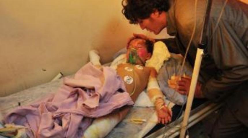 Bitlis&rsquo;te dengesini kaybeden &ccedil;ocuk tandıra d&uuml;şt&uuml;