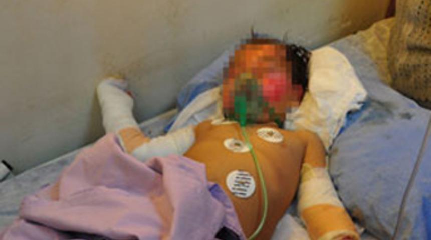 Tandıra d&uuml;şen Nazlıcan &ouml;ld&uuml;