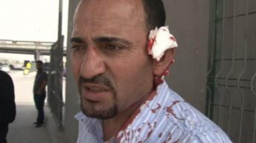 Metrob&uuml;s yolunda hastanelik oldu