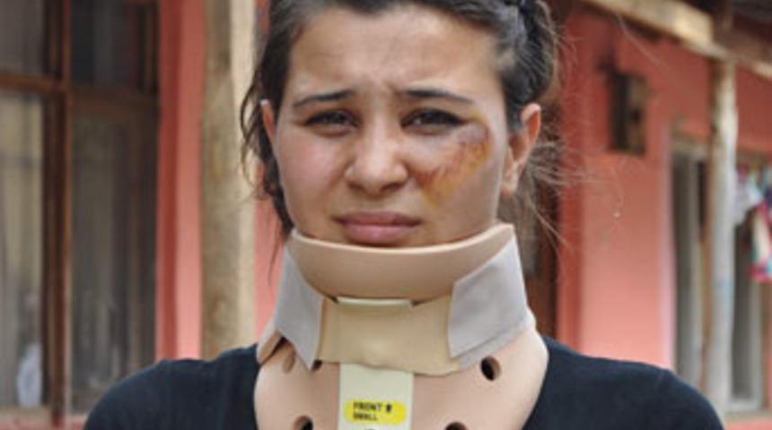 Eşinin başında kaskı par&ccedil;aladı