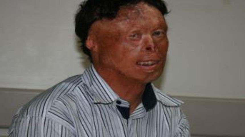 T&uuml;rkiye&rsquo;nin D&ouml;rd&uuml;nc&uuml; Y&uuml;z Nakli Yapılıyor