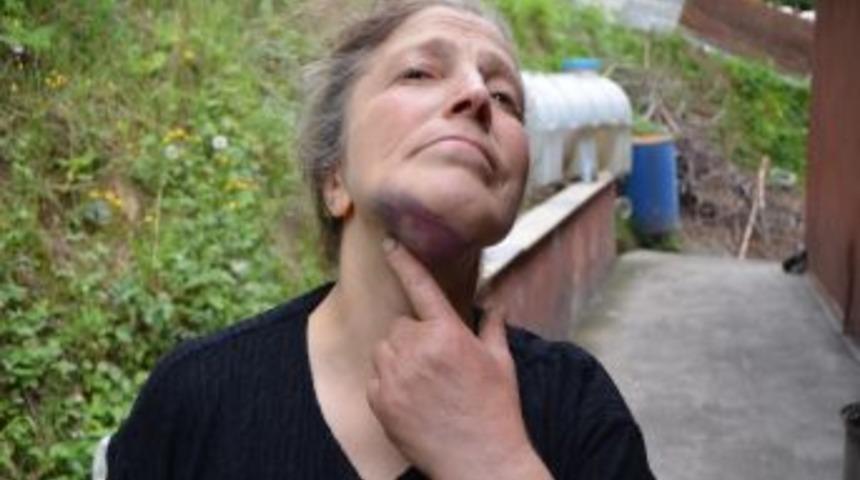 Anneler G&uuml;n&uuml;'nde, &Ouml;z Annesini Yaralayan Gen&ccedil;, Tutuklandı