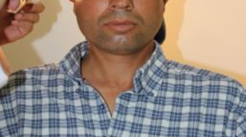 Psikolojisini Bozan Kep&ccedil;e Kulaklarından Kurtuldu