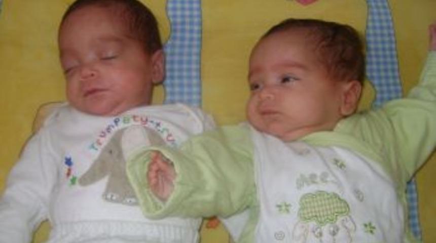 Premat&uuml;re Olarak D&uuml;nyaya Gelen H&uuml;ma Ve H&uuml;da Hayata Tutundu