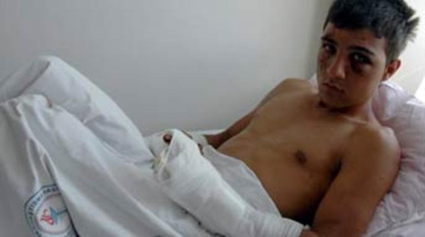 Vahşet, kız y&uuml;z&uuml;nden