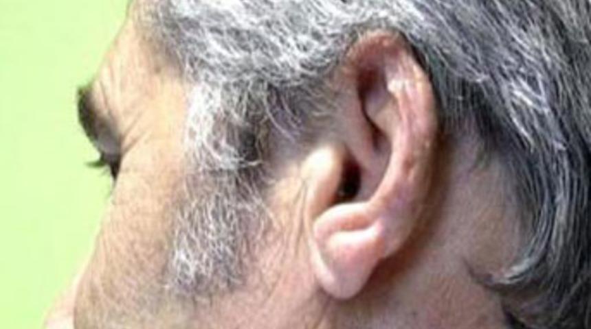 Kavgada kulağını ısırıp koparttı