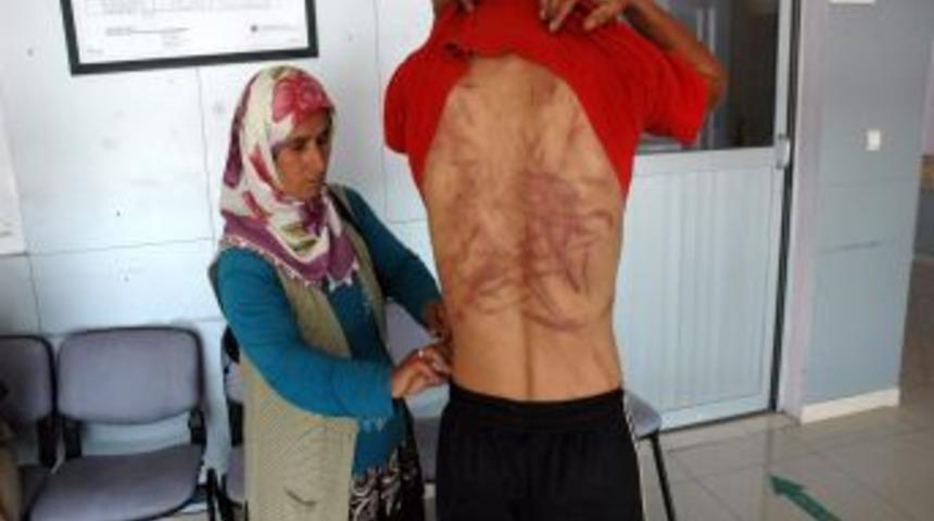 16 Yaşındaki &Ccedil;ocuğa İnanılmazı İşkence