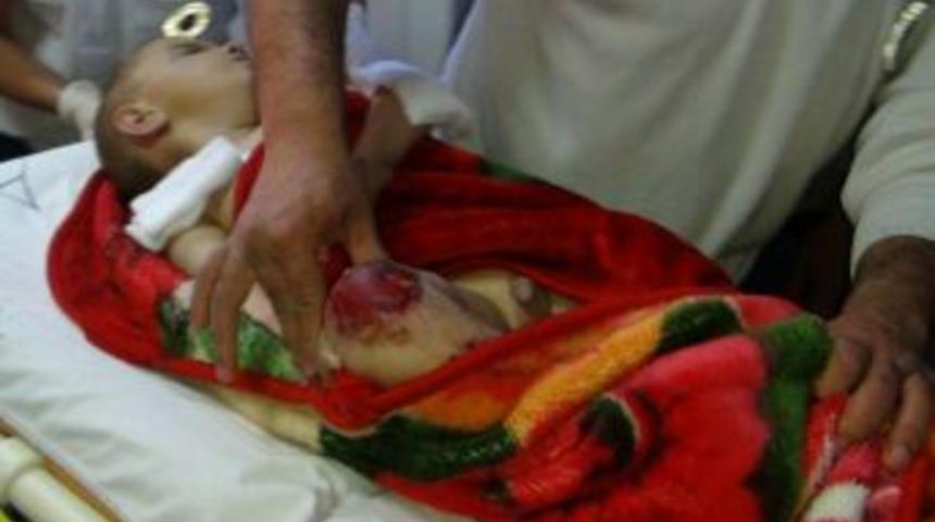 Suriye'de Yaralanan Biri Bebek 6 Kişi Hatay'a Getirildi