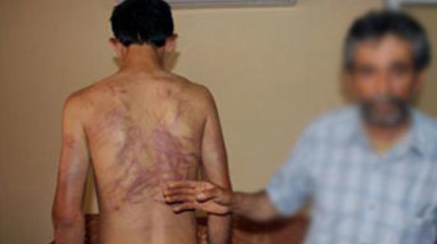 Hırsızlıkla suçlanan gence akılalmaz işkence