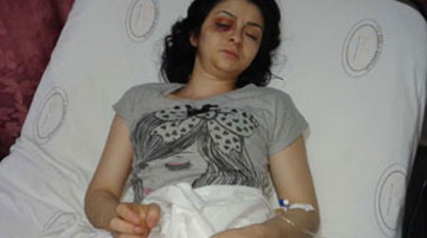 Karısını kızgın yağla haşladı