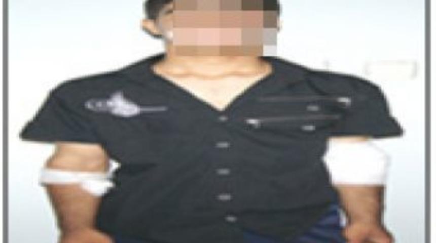 Molotofla Sadece Parmakları Değil, Gelecekleri De Kararıyor