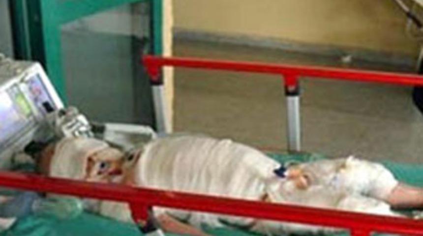 Süt kazanında can verdi