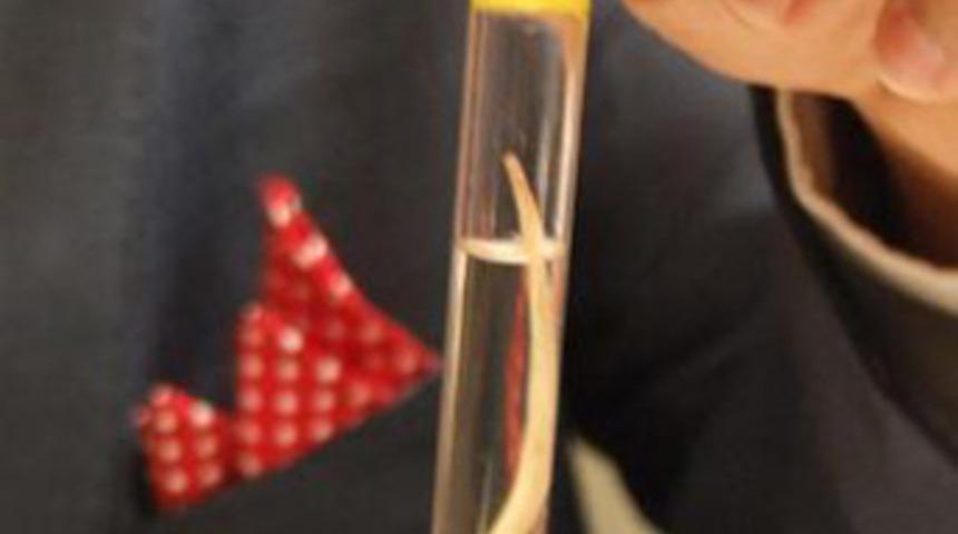 Balık kıl&ccedil;ığı karaciğerine saplandı