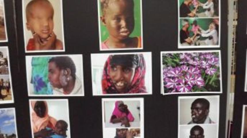 Afrika&rsquo;ya Giden G&ouml;n&uuml;ll&uuml; Doktorlar &Ccedil;orlu&rsquo;da Fotoğraf Sergisi A&ccedil;tı