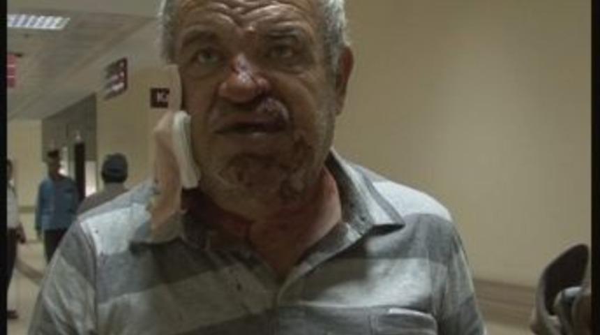 Kangal K&ouml;peği Bu Hale Getirdi