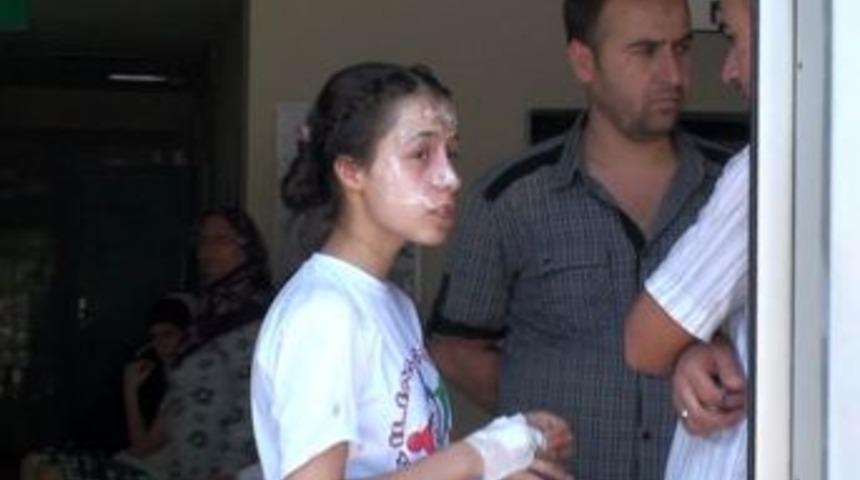 Deney Sırasında Patlama: 6 &Ouml;ğrenci Yaralı