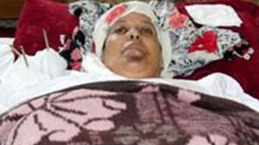 Yoğun bakımdayken pencereden d&uuml;şt&uuml;