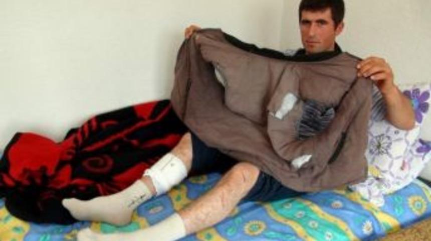 (&ouml;zel Haber) Ayı Saldırısına Uğrayan &Ccedil;oban Silah Sesleri Sayesinde &Ouml;l&uuml;mden D&ouml;nd&uuml;