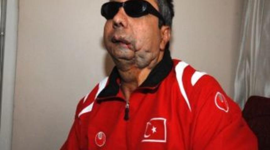 G&ouml;rme Engelli G&uuml;neydoğu Gazisi Milli Takıma &Ccedil;ağırıldı