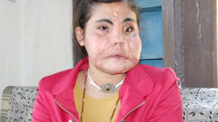 Y&uuml;z nakli yapılan Hatice iş istedi