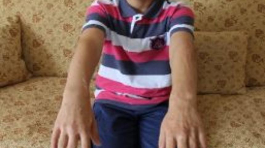 Tıp Merkezini Kapattıran Yanık Olayı