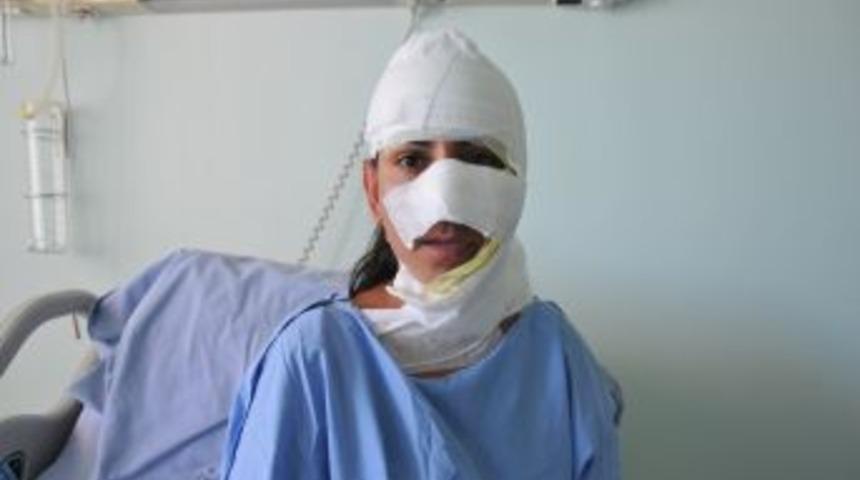 Y&uuml;z&uuml;ne Asit D&ouml;ken Saldırganları Tanımıyor