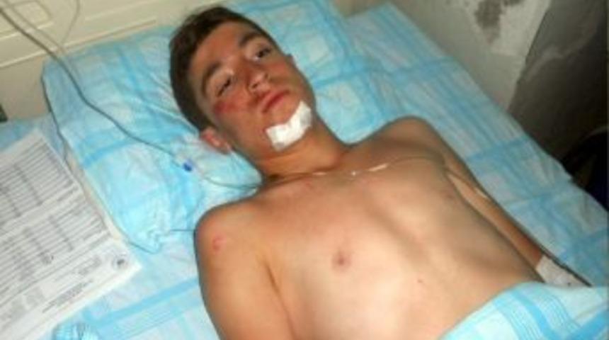 Bisikletten D&uuml;şen Gen&ccedil; Ağır Yaralandı