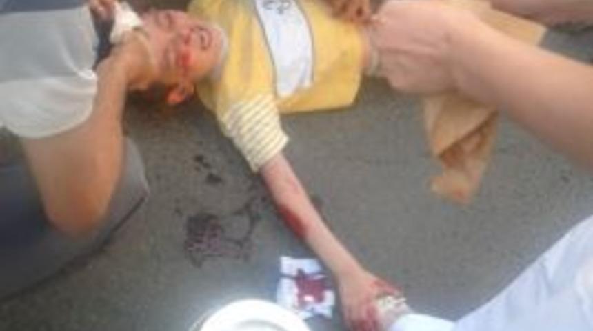 Otomobilin &Ccedil;arptığı &Ccedil;ocuk Yaralandı